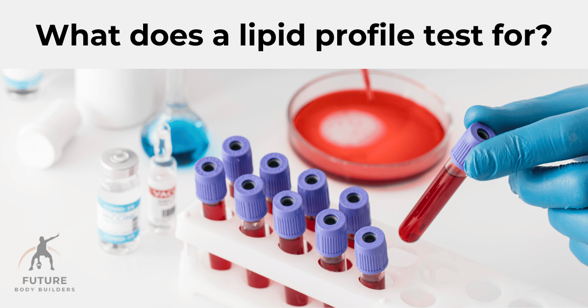 Read more about the article What does a Lipid Profile Test for?